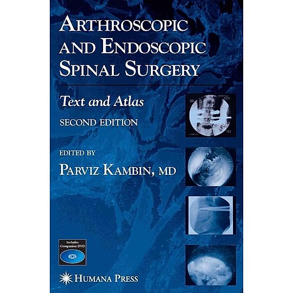 Arthroscopic and Endoscopic Spinal Surgery