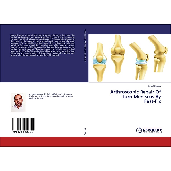 Arthroscopic Repair Of Torn Meniscus By Fast-Fix, Emad Shohdy