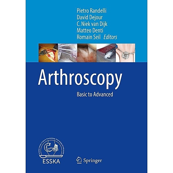 Arthroscopy