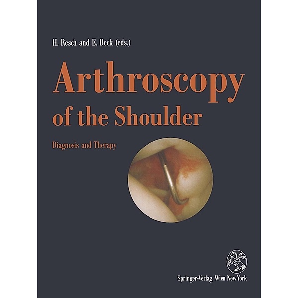 Arthroscopy of the Shoulder