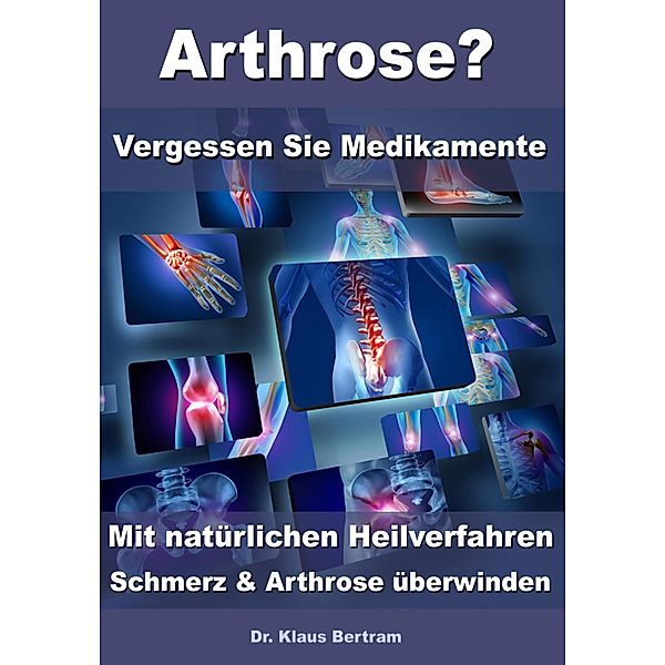 Arthrose? - Vergessen Sie Medikamente - Mit natürlichen Heilverfahren Schmerz & Arthrose überwinden, Klaus Bertram