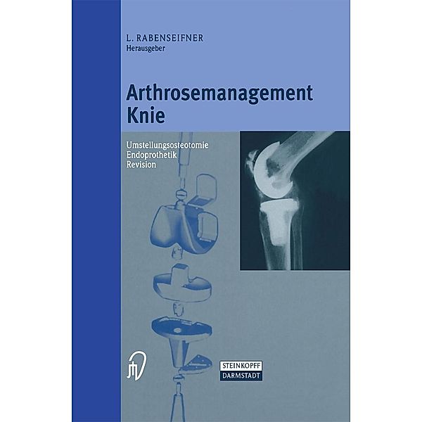 Arthrosemanagement Knie