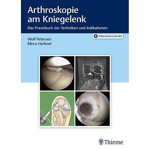 Arthroskopie am Kniegelenk, Wolf Petersen, Mirco Herbort