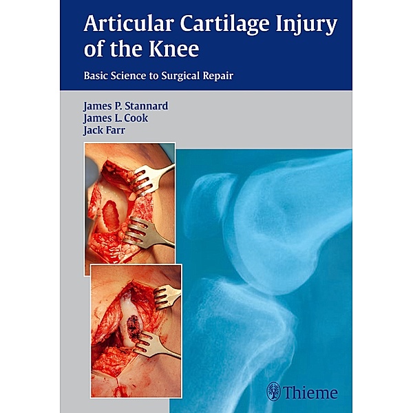Articular Cartilage Injury of the Knee, James P. Stannard, James L. Cook, Jack Farr
