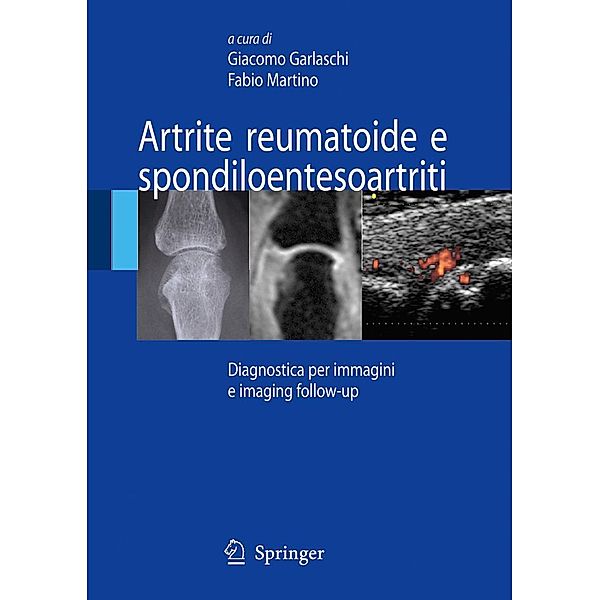 Artrite reumatoide e spondiloentesoartriti, Fabio Martino, Giacomo Garlaschi