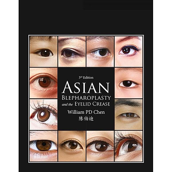 Asian Blepharoplasty and the Eyelid Crease E-Book, William P. Chen