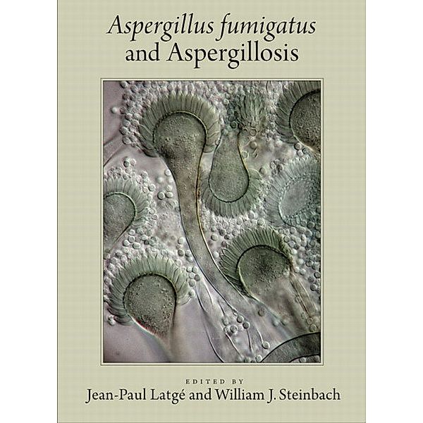 Aspergillus Fumigatus and Aspergillosis