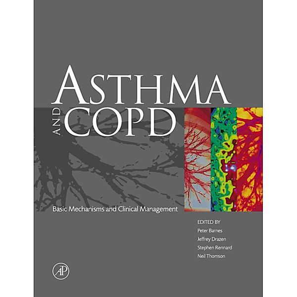 Asthma and COPD, Peter J. Barnes, Jeffrey M. Drazen, Stephen I. Rennard, Neil C. Thomson