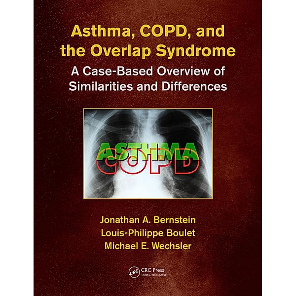 Asthma, COPD, and Overlap