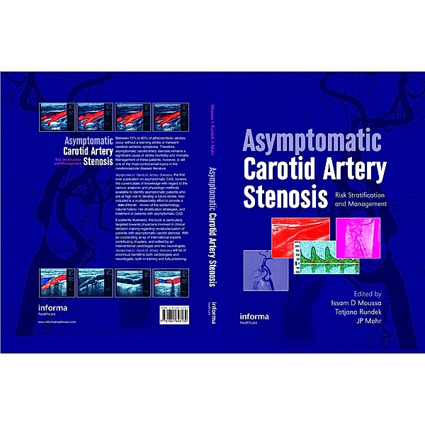 Asymptomatic Carotid Artery Stenosis