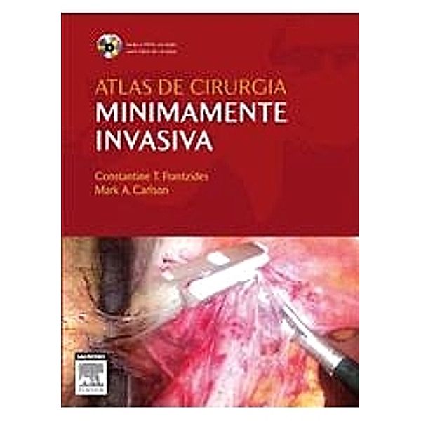 Atlas De Cirurgia Minimamente Invasiva, Mark A. Carlson, Constantine Frantzides