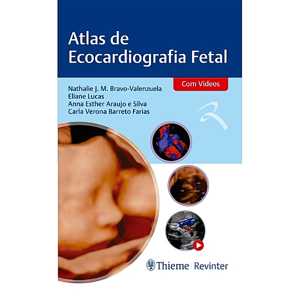 Atlas de Ecocardiografia Fetal, Nathalie J. M. Bravo-Valenzuela, Eliane Lucas, Anna Esther Araujo Silva, Carla Verona Barreto Farias