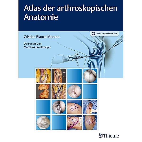 Atlas der arthroskopischen Anatomie