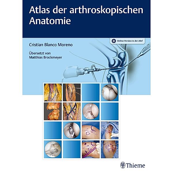 Atlas der arthroskopischen Anatomie, Cristian Blanco Moreno