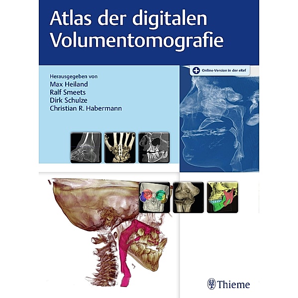 Atlas der digitalen Volumentomografie
