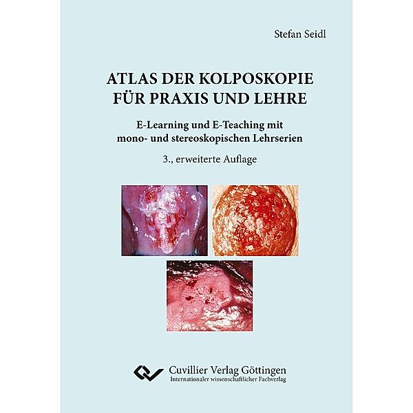 Atlas der Kolposkopie für Praxis und Lehre