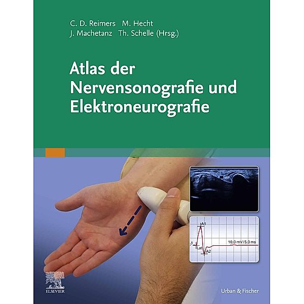 Atlas der Nervensonografie und Elektroneurografie