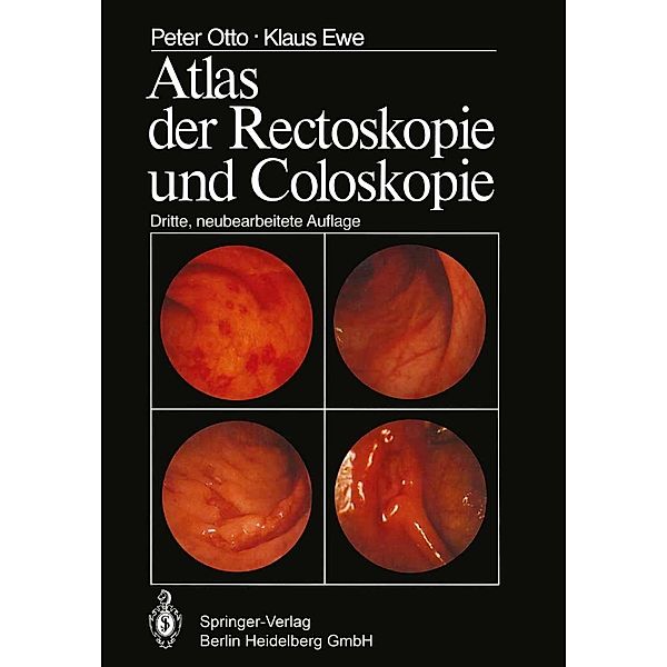 Atlas der Rectoskopie und Coloskopie, P. Otto, K. Ewe