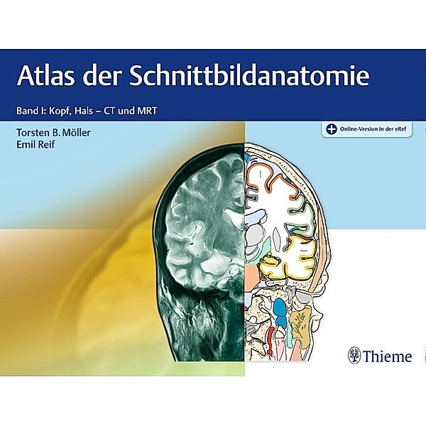 Atlas der Schnittbildanatomie, Torsten B. Möller, Emil Reif