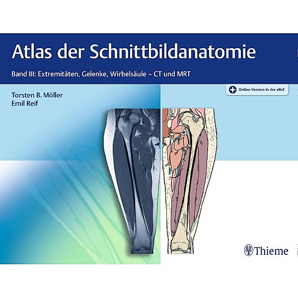 Atlas der Schnittbildanatomie, Torsten Bert Möller, Emil Reif