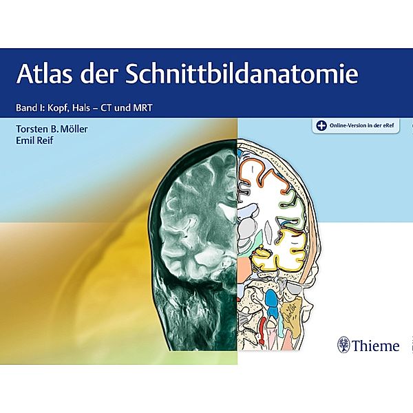 Atlas der Schnittbildanatomie, Torsten Bert Möller, Emil Reif