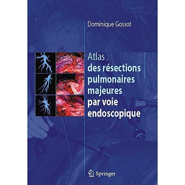 Atlas des résections pulmonaires majeures par voie endoscopique, Dominique Gossot