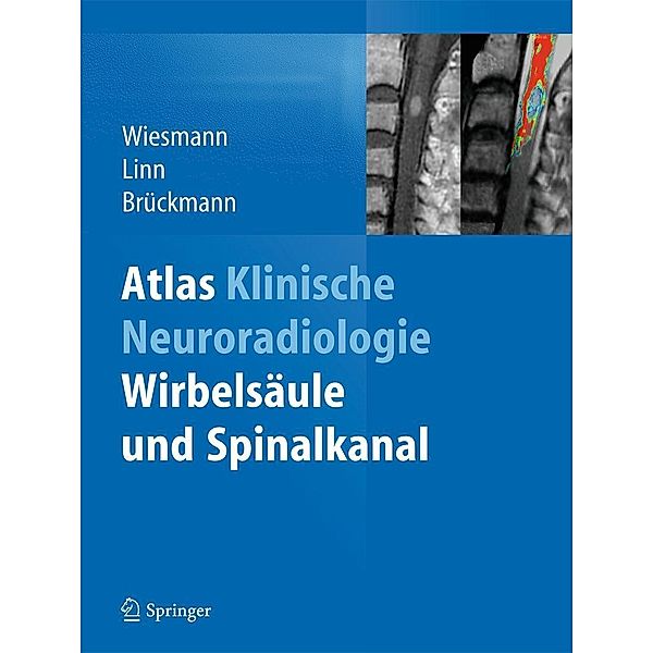 Atlas Klinische Neuroradiologie