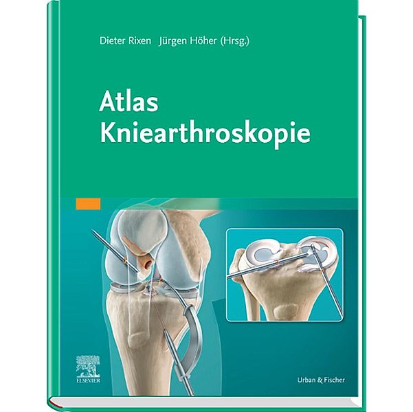 Atlas Kniearthroskopie