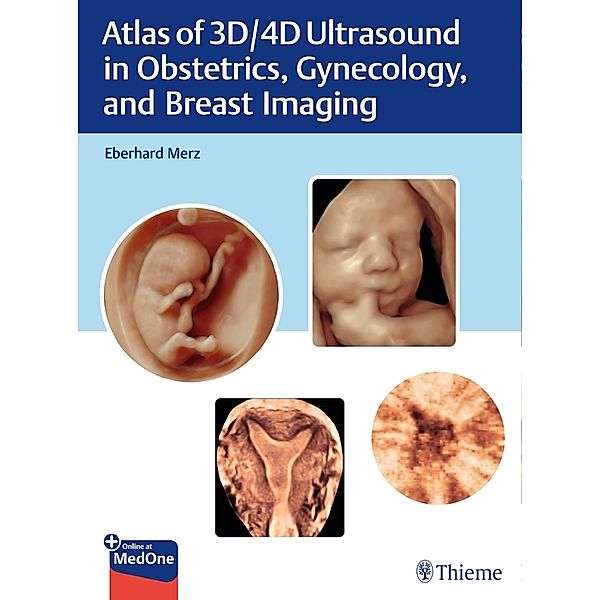 Atlas of 3D/4D Ultrasound in Obstetrics, Gynecology, and Breast Imaging, Eberhard Merz