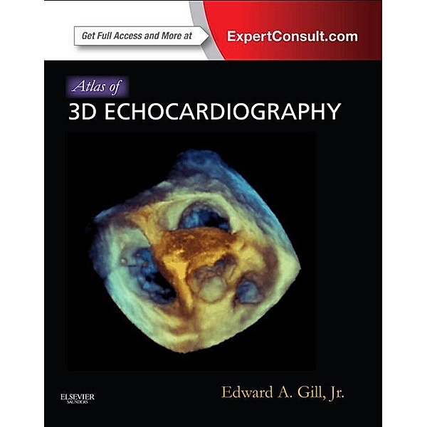Atlas of 3D Echocardiography E-Book, Edward A. Gill, Lisa Sugeng, Roberto Lang