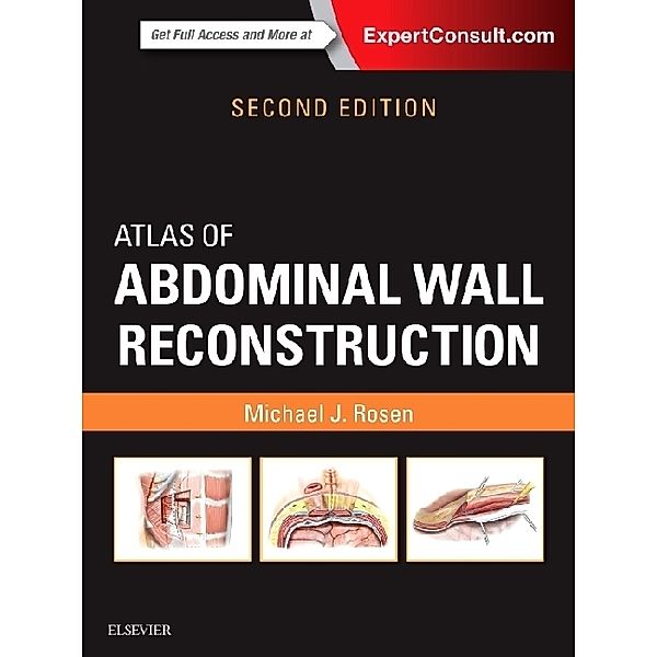 Atlas of Abdominal Wall Reconstruction, Michael J. Rosen