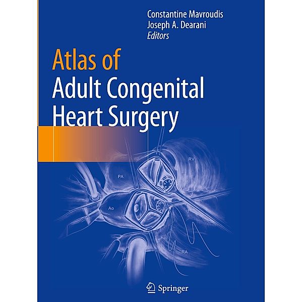 Atlas of Adult Congenital Heart Surgery