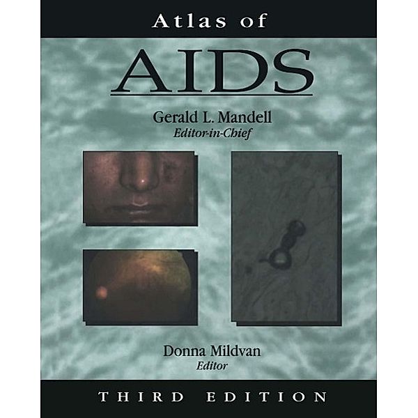 Atlas of AIDS