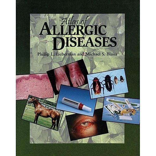 Atlas of Allergic Diseases