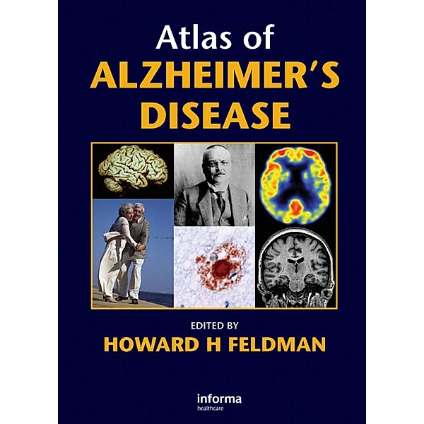 Atlas of Alzheimer's Disease, Howard Feldman