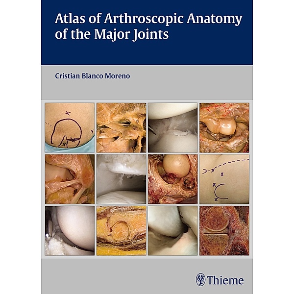 Atlas of Arthroscopic Anatomy of the Major Joints, Cristian Blanco Moreno