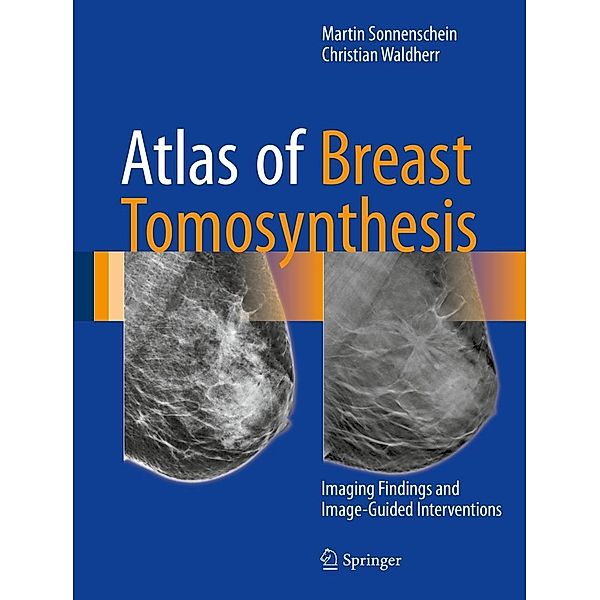 Atlas of Breast Tomosynthesis, Martin Sonnenschein, Christian Waldherr
