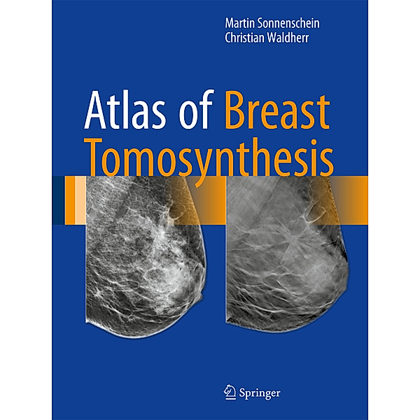 Atlas of Breast Tomosynthesis, Martin Sonnenschein, Christian Waldherr