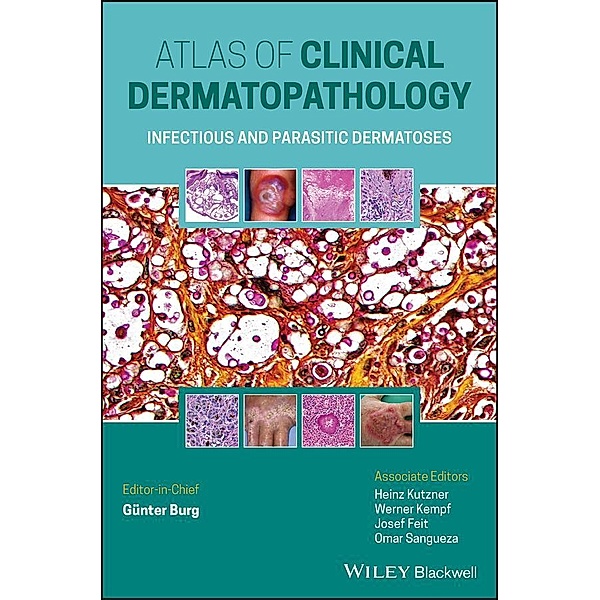 Atlas of Clinical Dermatopathology, Günter Burg, Werner Kempf, Heinz Kutzner, Josef Feit, Ram Chandra Adhikari