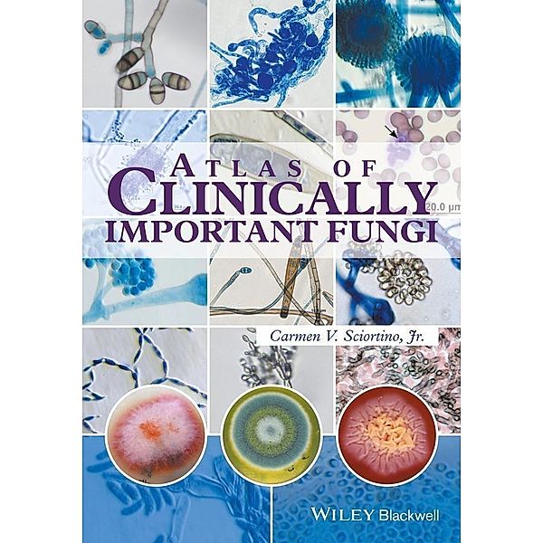 Atlas of Clinically Important Fungi, Carmen V. Sciortino