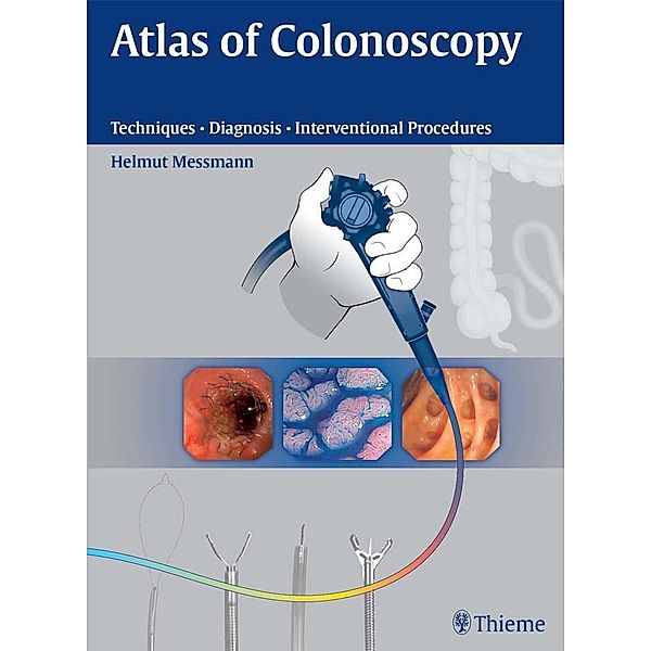Atlas of Colonoscopy / Thieme, Helmut Messmann