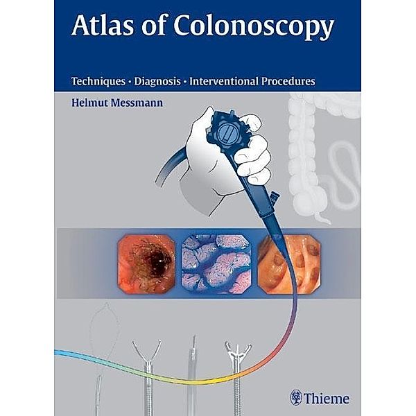 Atlas of Colonscopy