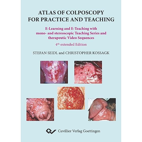 Atlas of Colposcopy for Practice and Teaching