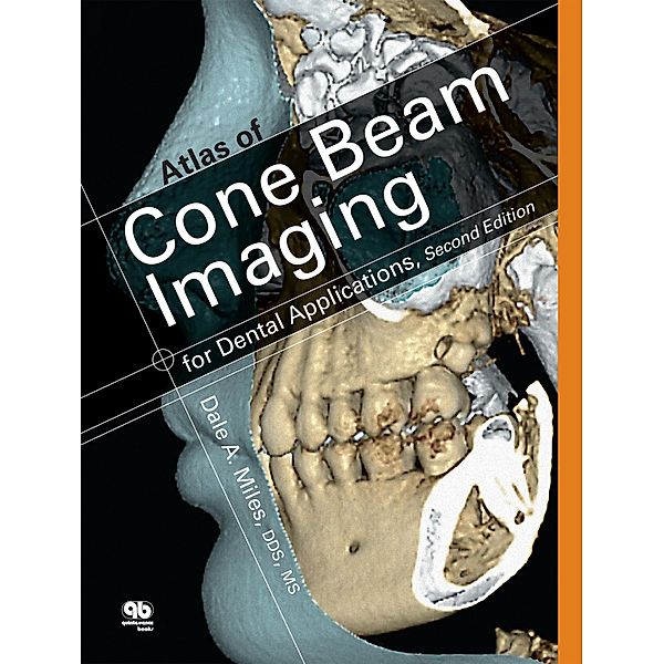 Atlas of Cone Beam Imaging for Dental Applications, Dale A. Miles