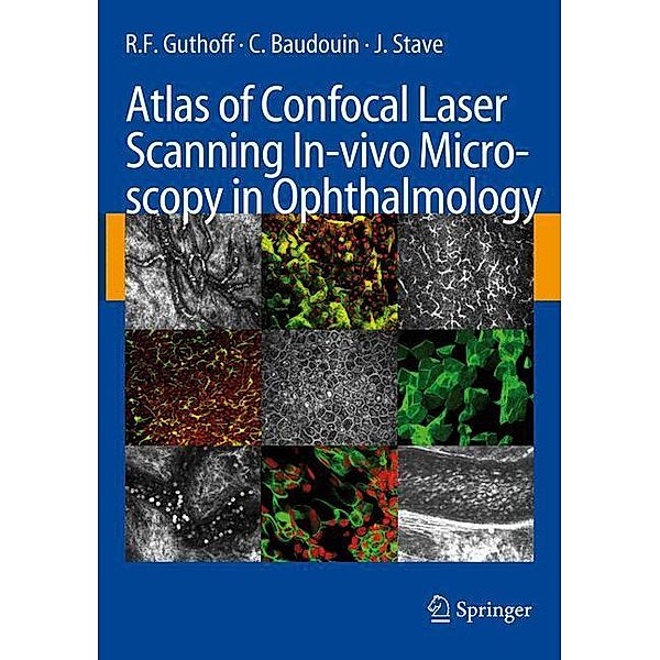 Atlas of Confocal Laser Scanning In-vivo Microscopy in Ophthalmology, R.F. Guthoff, C. Baudouin, J. Stave