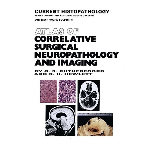 Atlas of Correlative Surgical Neuropathology and Imaging / Current Histopathology Bd.24, G. S. Rutherfoord, R. H. Hewlett