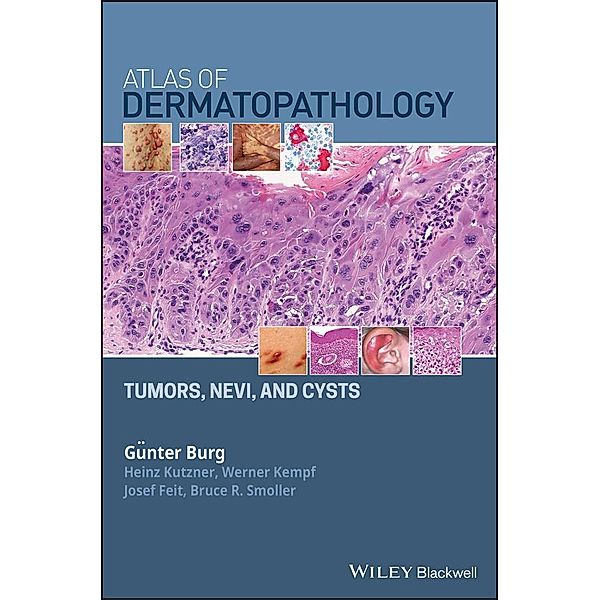 Atlas of Dermatopathology, Günter Burg, Heinz Kutzner, Werner Kempf, Josef Feit, Bruce R. Smoller