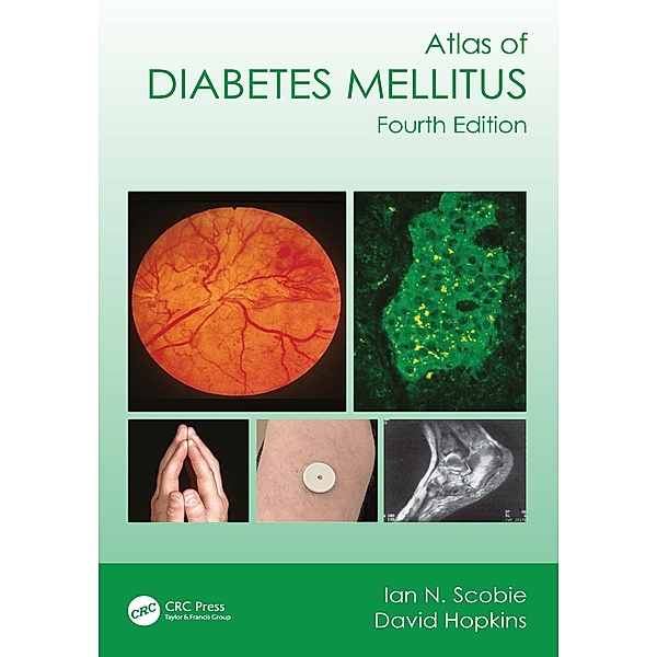 Atlas of Diabetes Mellitus, Ian N. Scobie, David Hopkins