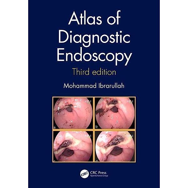 Atlas of Diagnostic Endoscopy, 3E, Mohammad Ibrarullah