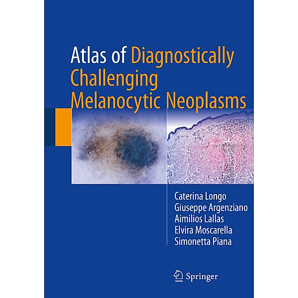 Atlas of Diagnostically Challenging Melanocytic Neoplasms, Caterina Longo, Giuseppe Argenziano, Aimilios Lallas, Elvira Moscarella, Simonetta Piana